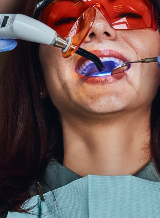 Dental Whitening 1 - Cas Dental