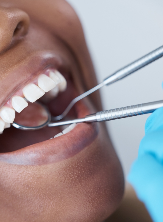 Periodontia Ayamonte 1 - Cas Dental