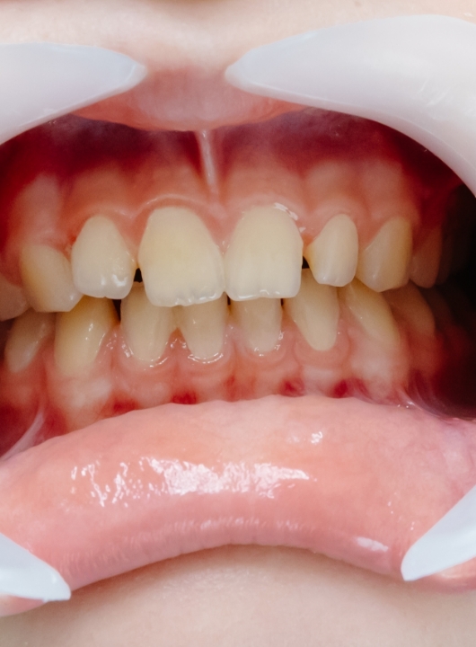 Periodontia Ayamonte 2 - Cas Dental
