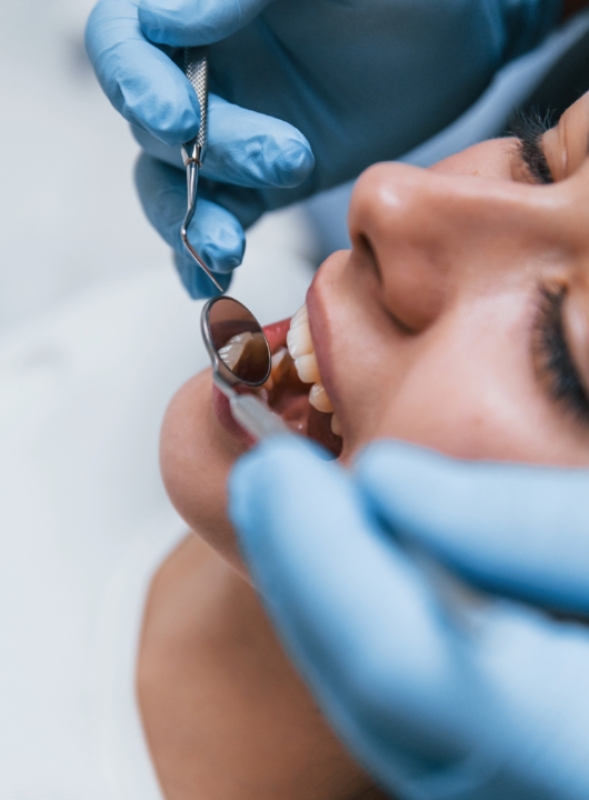 Bruxismo 2 - Cas Dental