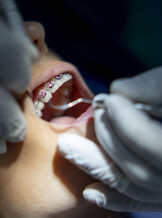 Orthodontics 2 - Cas Dental