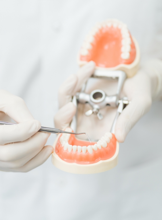 Dental implants 1 - Cas Dental